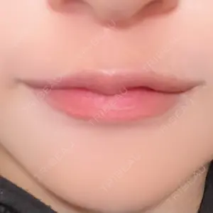 MKクリニック MKクリニック 日本橋院口コミ