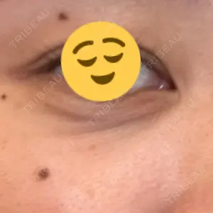 CZEN CLINIC 銀座院口コミ