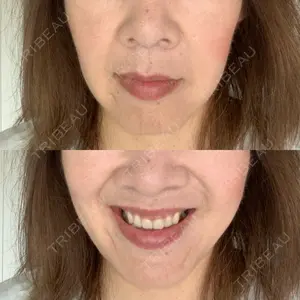 ASTRA BEAUTY CLINIC口コミ