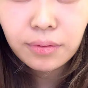 HINATA クリニック口コミ