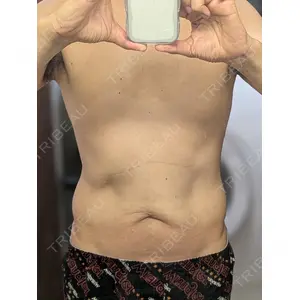 脂肪吸引の森クリニック 脂肪吸引の森クリニック東京院口コミ