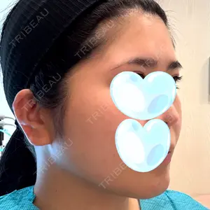 リッツ美容外科の口コミ