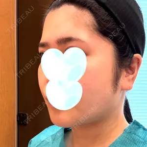 リッツ美容外科の口コミ