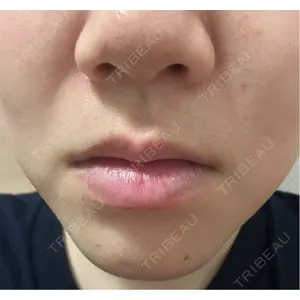 LiLAスキンクリニック中目黒 LiLAスキンクリニック中目黒口コミ