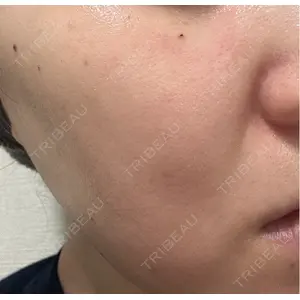 LiLAスキンクリニック中目黒 LiLAスキンクリニック中目黒口コミ