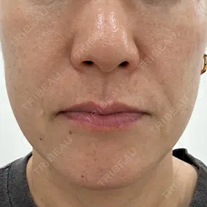 PureMe Skin Clinic（ピュアミースキンクリニック麻布）口コミ