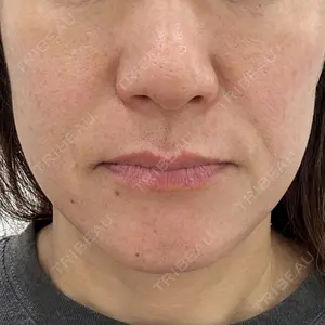 PureMe Skin Clinic（ピュアミースキンクリニック麻布）口コミ