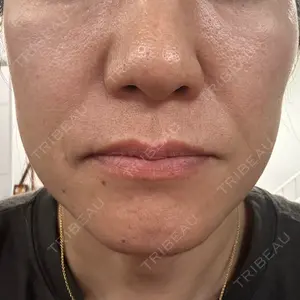 PureMe Skin Clinic（ピュアミースキンクリニック麻布）口コミ