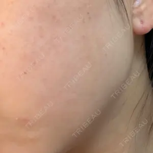 ルラ美容クリニック ルラ美容クリニック 池袋院口コミ