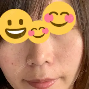 南青山TOKUNAKAクリニック口コミ