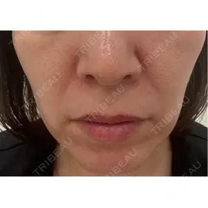 NARU Beauty Clinic NARU Beauty Clinic 【ナルクリ】 水戸院口コミ