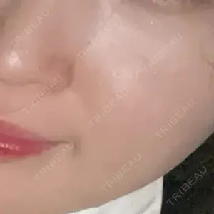 ゆきスキンクリニック 東池袋口コミ