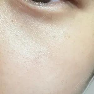 BISIN GINZA CLINIC口コミ