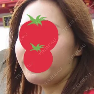 東京ココセランクリニック口コミ