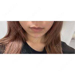 ルラ美容クリニック ルラ美容クリニック 仙台院 / ルラスキンクリニック 仙台院口コミ