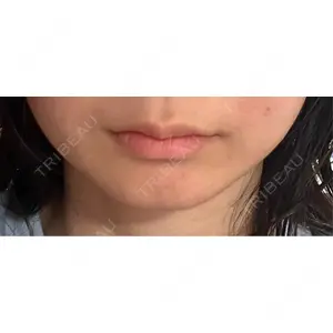 ルラ美容クリニック ルラ美容クリニック 渋谷本院口コミ