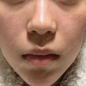 ルラ美容クリニック ルラ美容クリニック 札幌本院口コミ