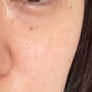 心斎橋KT美容クリニック口コミ