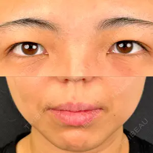 東京シンデレラ美容外科 東京シンデレラ美容外科 池袋院口コミ