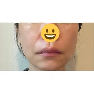 CZEN CLINIC 銀座院口コミ