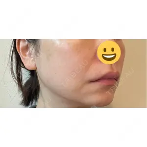 CZEN CLINIC 銀座院口コミ