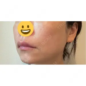 CZEN CLINIC 銀座院口コミ