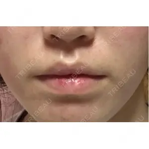BiBiクリニック口コミ