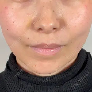 アリエル美容クリニック アリエル美容クリニック 水戸院口コミ