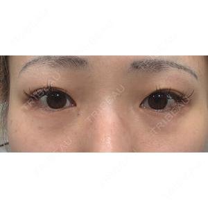 BITO BEAUTY CLINIC BITO BEAUTY CLINIC口コミ