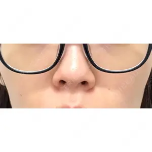 BISIN GINZA CLINIC口コミ