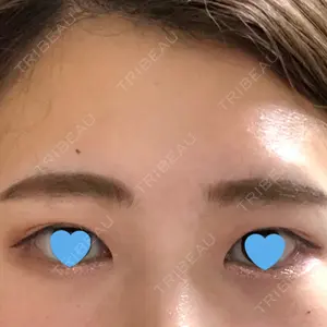 プロミス整形外科口コミ