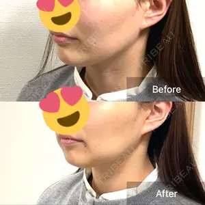 口コミ