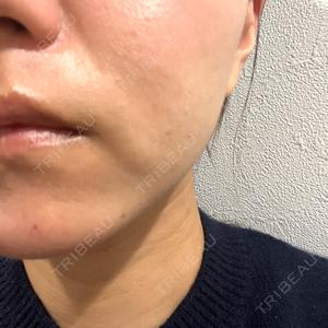 美容皮膚科 デュークリニック口コミ