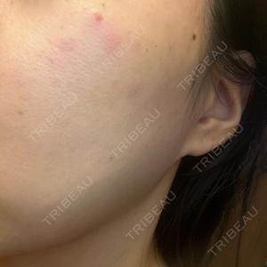 BITO BEAUTY CLINIC BITO BEAUTY CLINIC口コミ