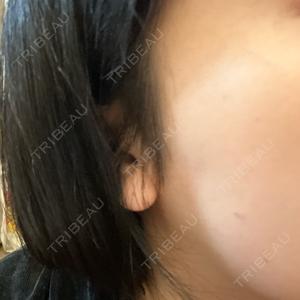 TCB東京中央美容外科 TCB東京中央美容外科 中野院口コミ