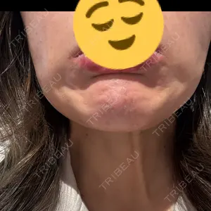 BON BON CLINIC BON BON CLINIC 銀座駅前本院口コミ