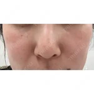 ルラ美容クリニック ルラ美容クリニック 札幌本院口コミ