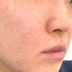 東京美容外科 東京美容外科 銀座院口コミ