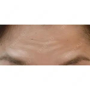 DMTC CLINIC DMTC美容皮膚科 大宮院口コミ