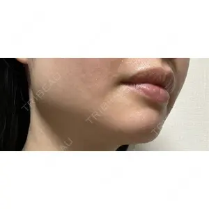 TCB東京中央美容外科 TCB東京中央美容外科 自由が丘院口コミ