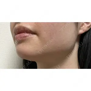 TCB東京中央美容外科 TCB東京中央美容外科 自由が丘院口コミ