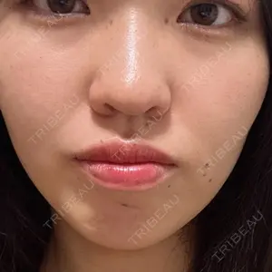 パーソナルビューティークリニック東京 【PBC TOKYO 銀座店】口コミ