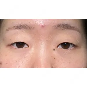 HAAB×DREAM BEAUTY CLINIC 大阪梅田院の