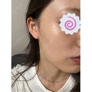 CZEN CLINIC 銀座院口コミ