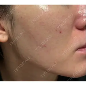 クレオビューティークリニック口コミ