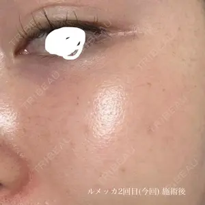 ルラ美容クリニック ルラ美容クリニック 大宮院 / ルラスキンクリニック 大宮院口コミ