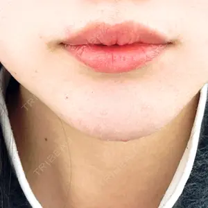 DMTC CLINIC DMTC CLINIC 日本橋院口コミ