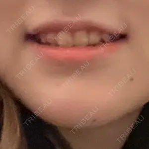 DMTC CLINIC DMTC CLINIC 日本橋院口コミ