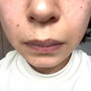 おおかみ美容のクリニック おおかみ美容のクリニック 新宿院口コミ