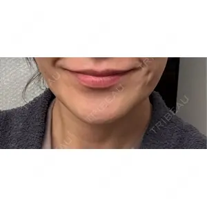 TAクリニック 札幌TAクリニック口コミ